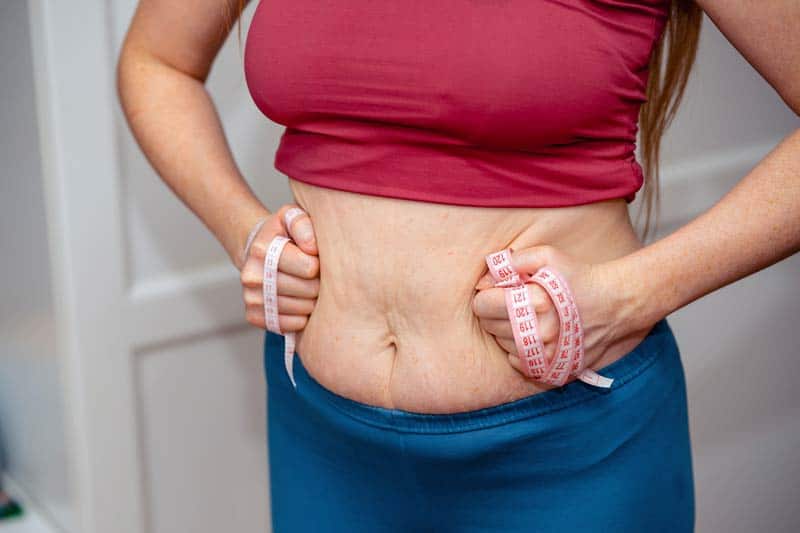 Skidanje kila nakon poroda